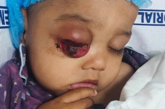 New-1